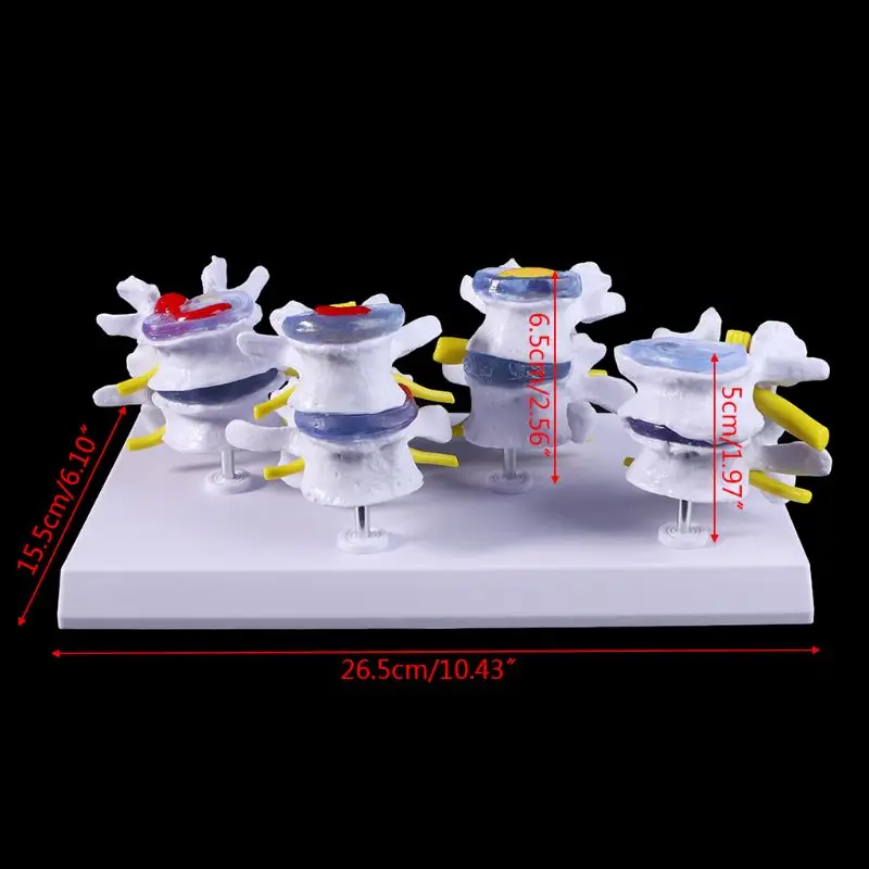 1 комплект, человеческая поясница, выщелающая статуя позвоночника, дисплей, манекен для медицинского обучения, обучающий инструмент