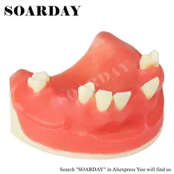 SOARDAY Стоматологическая красная Maxillary модель имплантата с мягкой силиконовой модель для практики модель образования