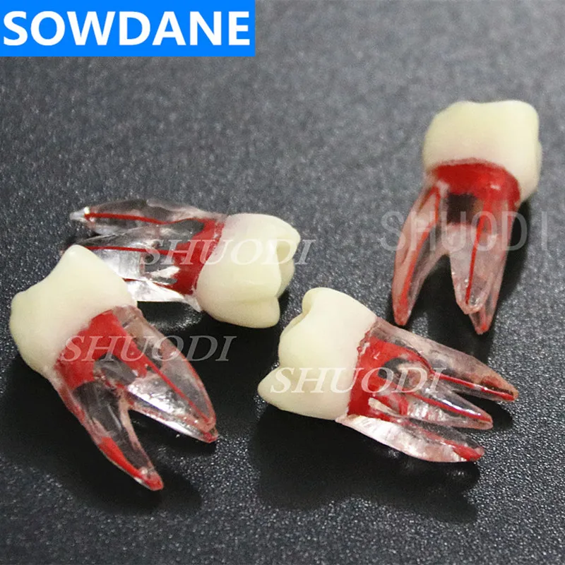 

4 Pcs 1:1 Resin Dental Endodontic Student Study Practice Operation Model Colored Root Canal and Pulp Transparent without files