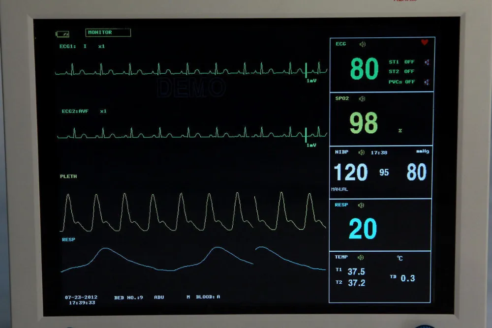 CE FDA Contec CMS8000 ветеринарный мультипараметрический Ветеринарный монитор пациента для животных