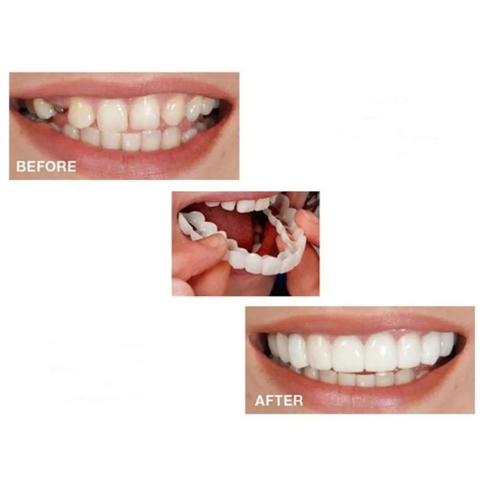 

Tooth Instant Perfect Smile Flex Teeth Whitening Smile False Teeth Cover