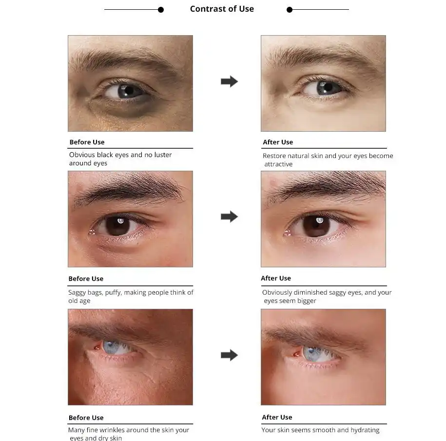 mens puffy eye cream