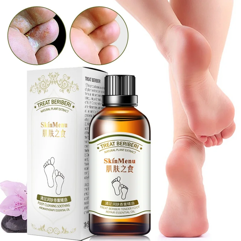 Buy Foot Care Oil Moisturizing Nourishing Remove Foot