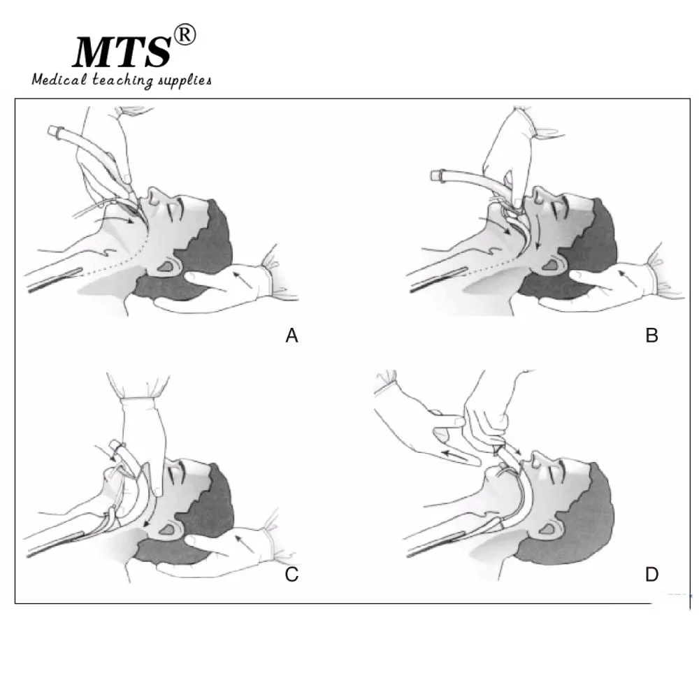  10pcs/lot Medical Disposable PVC laryngeal mask anesthesiology adults and children multi-size for h - 33029159624