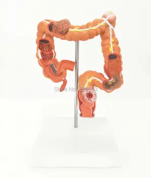 

human skull brain skeleton anatomical Human Colon Model with Pathologies Diseases Digestive Pathology Intestine System