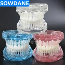 Modèle orthodontique de modèle dentaire Standard de dent de 1 pièce pour la clinique d'étude dentaire de Communication Patient