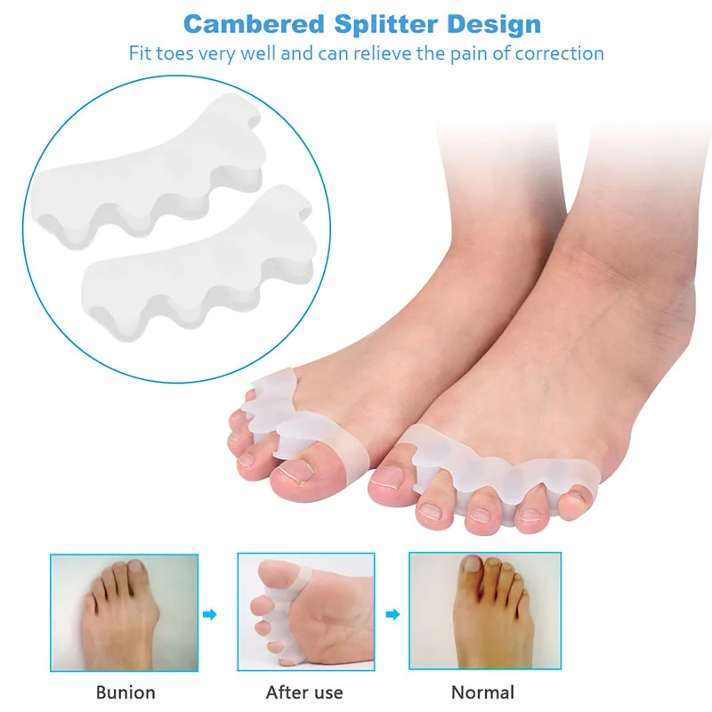 Soumit 5pcs/sets Pain Relieve Pad Orthotics Overlapping Toes Correction Care Cushiontoe separators For correction pads toes