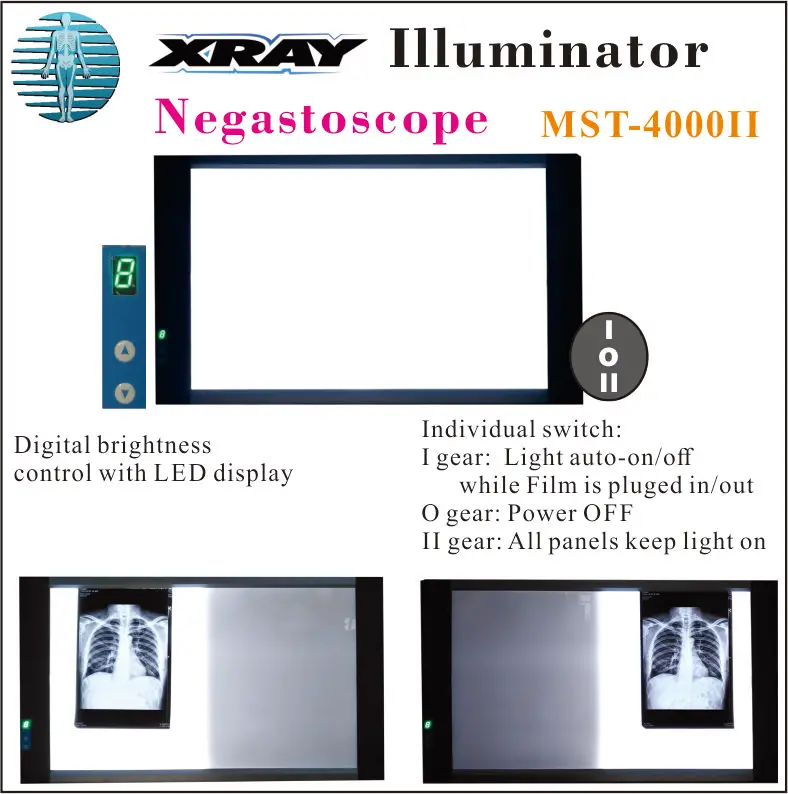 LED x ray illuminator , X ray film viewer box, x rary negatoscope MST