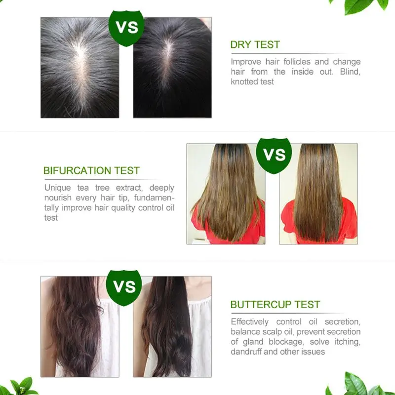 Чайное дерево эссенция для роста волос Гладкая против выпадения восстанавливающая питательная эссенция 10 мл