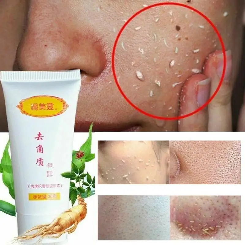 Ginger Exfoliating Gel Facial Scrubs Hyaluronic Acid Facial Cleanser Nourishing Cleanser Moisturizing Face Wash Anti-spot Gel