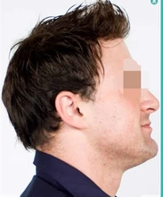 100% European human hair toupee , HD full swiss lace (french lace ) hair replacement men toupee free shipping