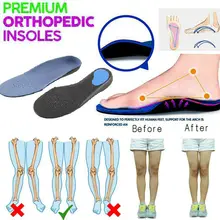 Ортопедические стельки от плоскостопия Cubitus Varus ортопедические ноги подушки колодки Уход стельки