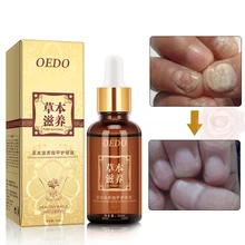 Травяной грибковый Уход за ногтями, эфирное масло для рук и ног, отбеливание пальцев ног, удаление грибка, инфекция, уход за ногами, лак для ногтей