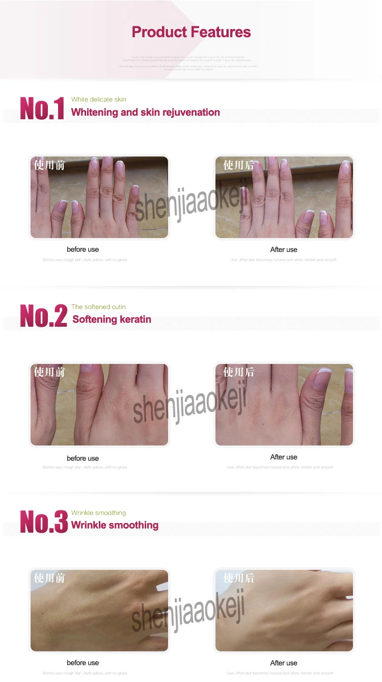 x4