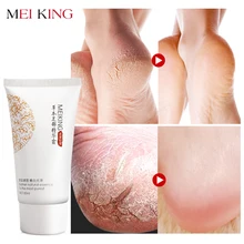 MEIKING Baby Foot Care Deep Exfoliation for Feet peel Anti Drying Remove Dead Skin Foot Lotion Exfoliating Cream foot mask 80g