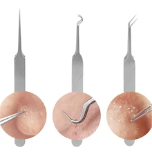 3 шт./компл. игольчатый Пинцет для прыщей пятна угорь, прыщ, акне удаления острым изгиб экстрактор Нержавеющая сталь уход за кожей лица Уход за кожей