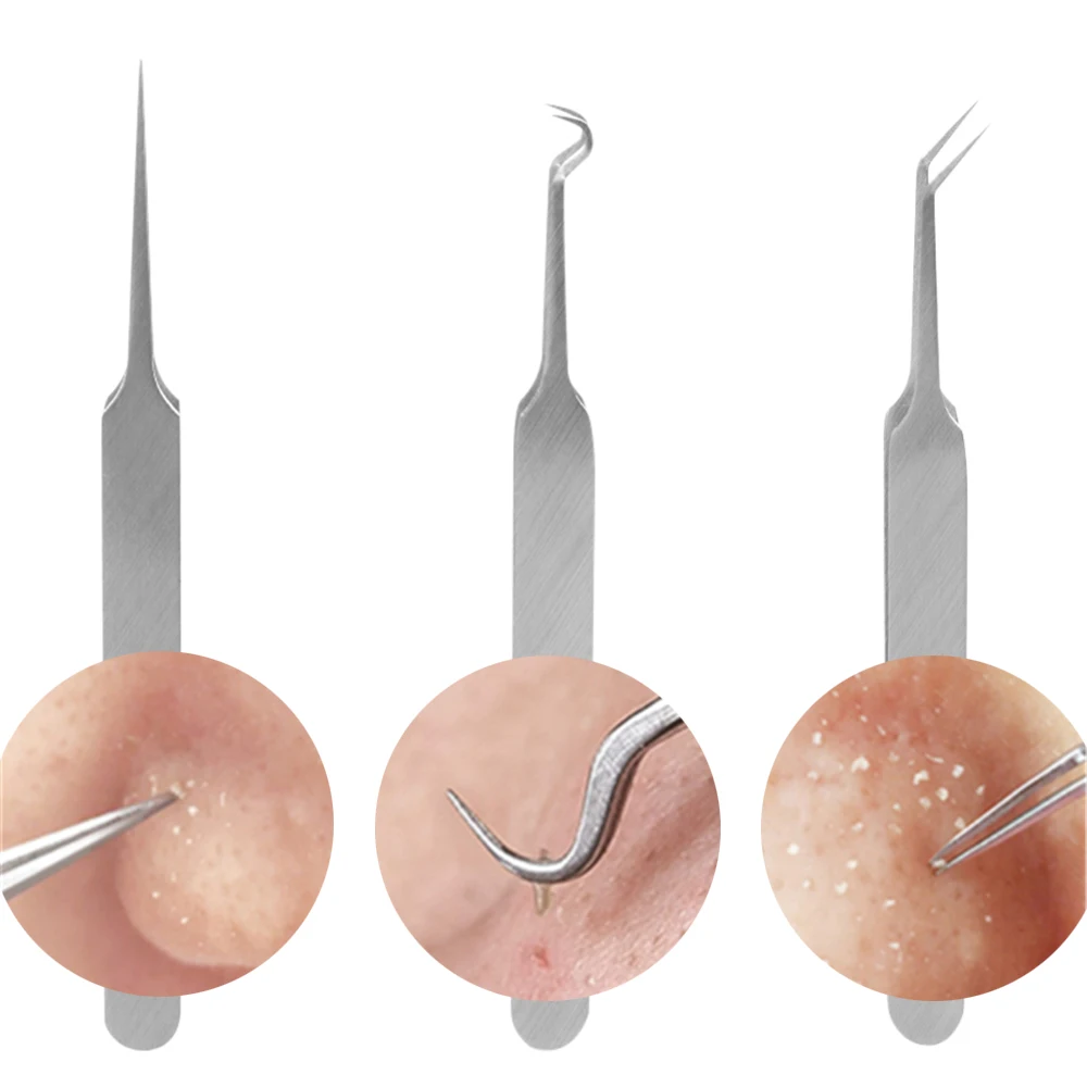 Buy 3Pcs/Set Acne Needle Tweezers Blemish Blackhead Pimples Acne Removal