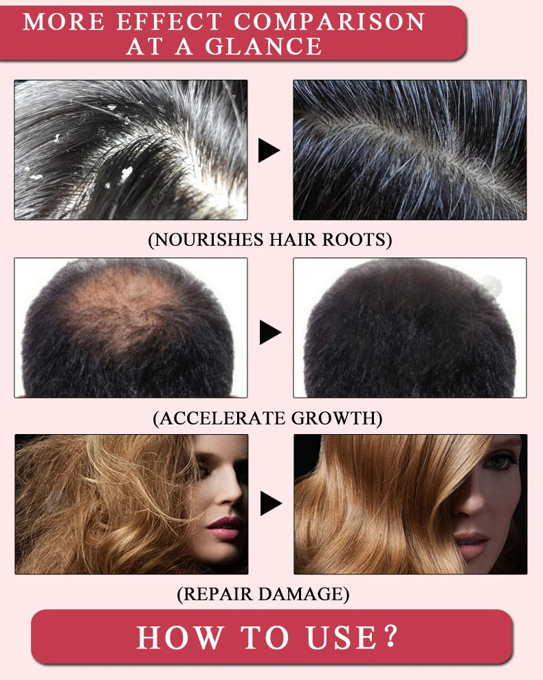 Новое поступление, продукты для роста волос от Andrea, масло имбиря для роста волос, более быстрый рост волос, шампунь для имбиря, лечение выпадения волос
