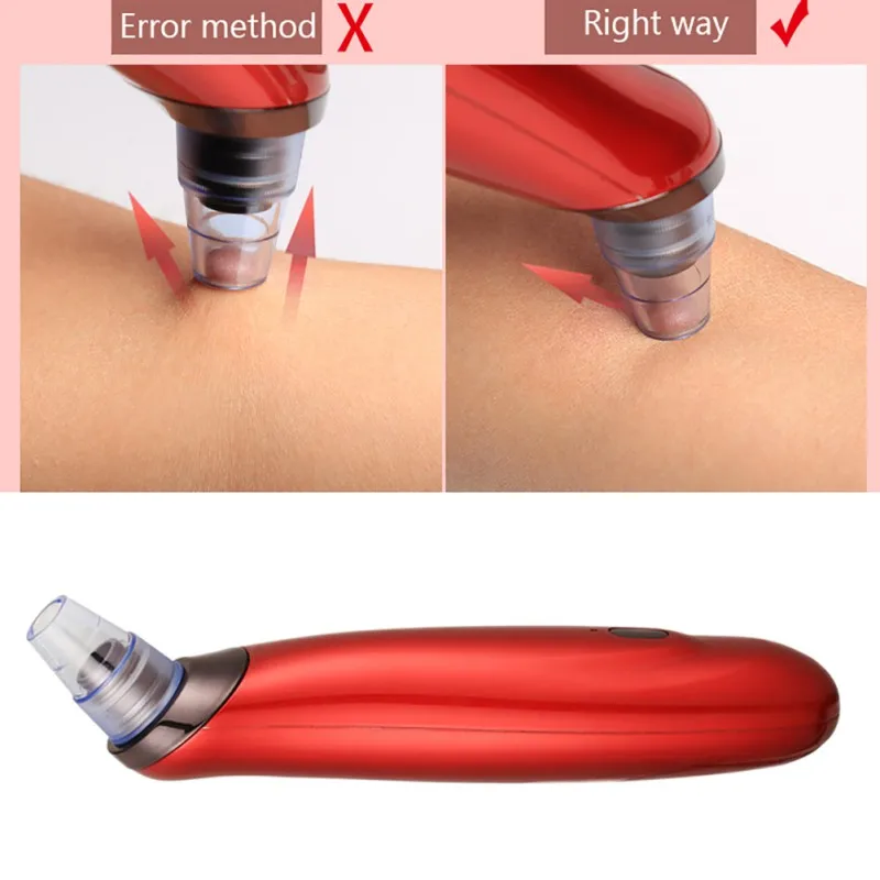 Electric-Blackhead-Remover-Machine-Instrument-Vacuum-Black-Head-Acne-Remover-Tool-Beauty-Face-Skin-Care-3 (2)