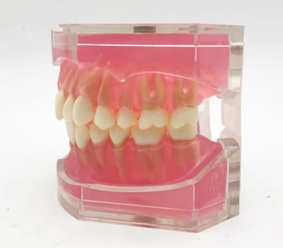 

Dental teeth model study teach standard model with removable teeth