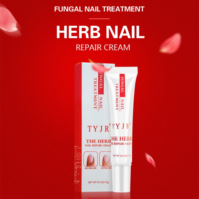 Nail Treatment Care Essence Whitening Removal Gel Fungal Cream | Красота и здоровье