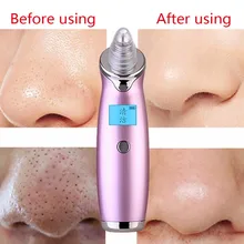 Уход за кожей пор вакуумная акне Удаление прыщей вакуумный инструмент для лица алмазное абразивное удаление дефектов кожи уход за кожей лица чистого P7
