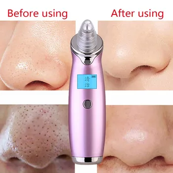 

Remover Skin Care Pore Vacuum Acne Pimple Removal Vacuum Suction Tool Facial Diamond Dermabrasion Face Clean P7