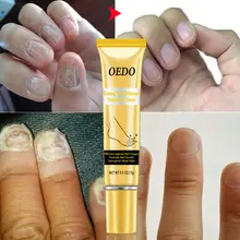 Лечение ногтей от грибка эссенция для ногтей и ноги отбеливающий носком ногтей Удаление грибка Onychomyco Уход за ногами и ногтями Гель Инструменты