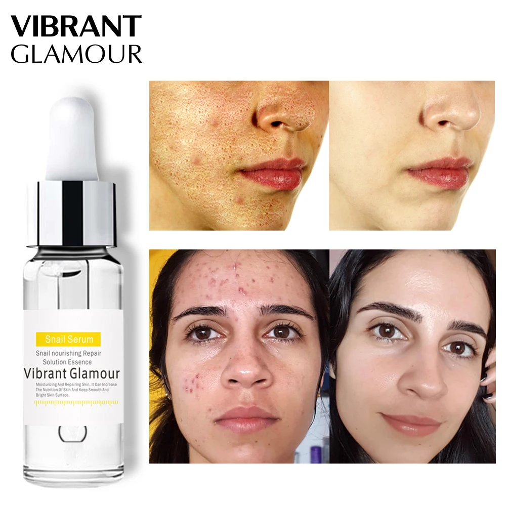 

VIBRANT GLAMOUR Snail 100% Plant Extract Face Serum Hyaluronic Acid Liquid Whitening Blemish Essence Mosturizing Anti-acne