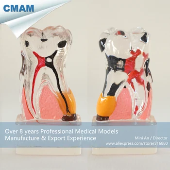

DH/13073, 4Times Bigger Periodontal Disease, Clear, Pathology Dental Model, Educational Teaching Anatomical Models
