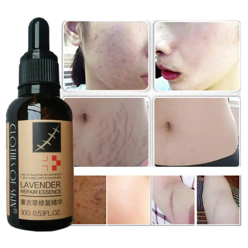 

30g Scar Repair Skin Essential Oil Lavender Essence Skin Care Natural Pure Remove Ance Burn Strentch Marks Scar Removal