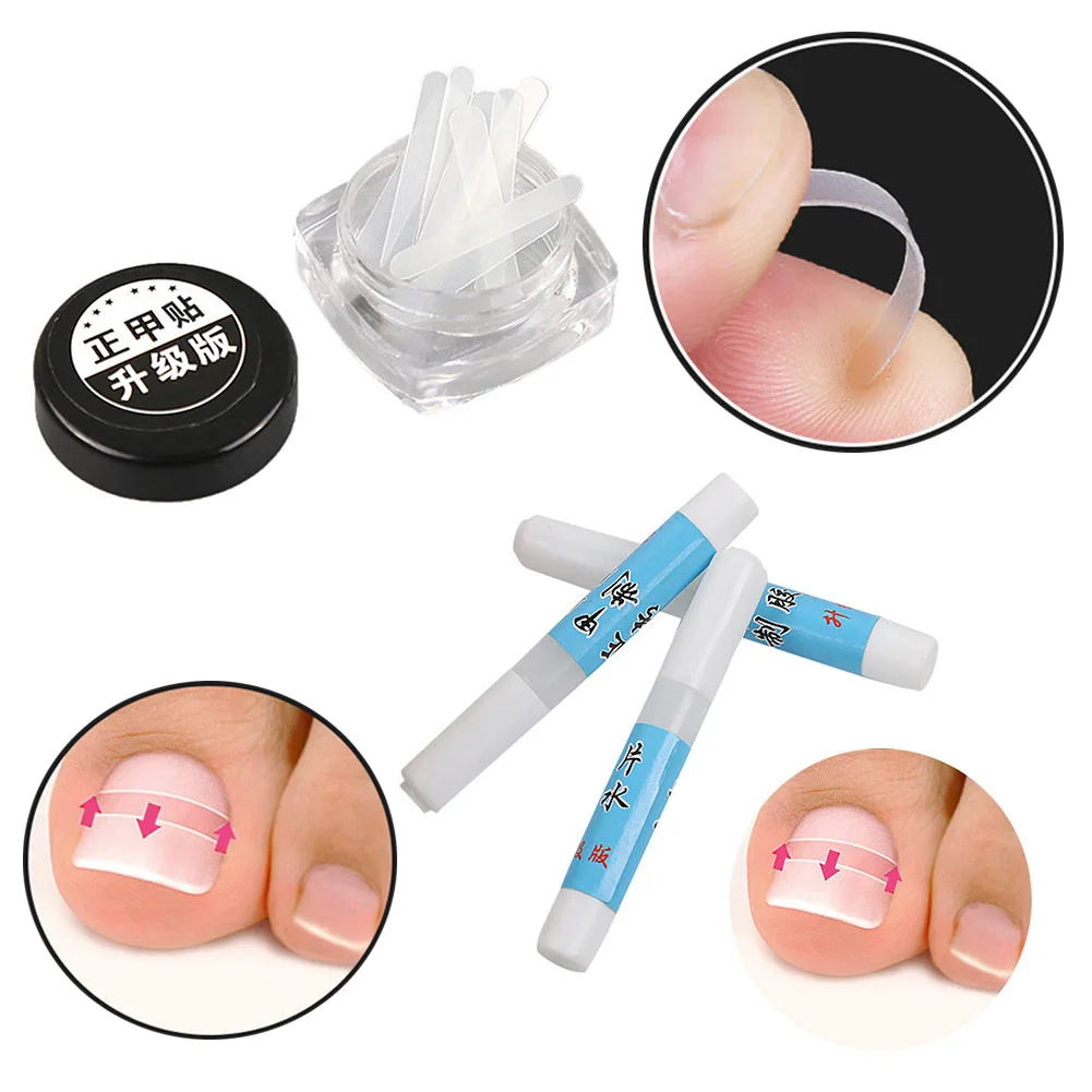 

1boxToe Nail Ingrown Correction Sticker Patch Paronychia File Elastic Patch And Orthopaedic Patch Glue Corrector Treatment Tools