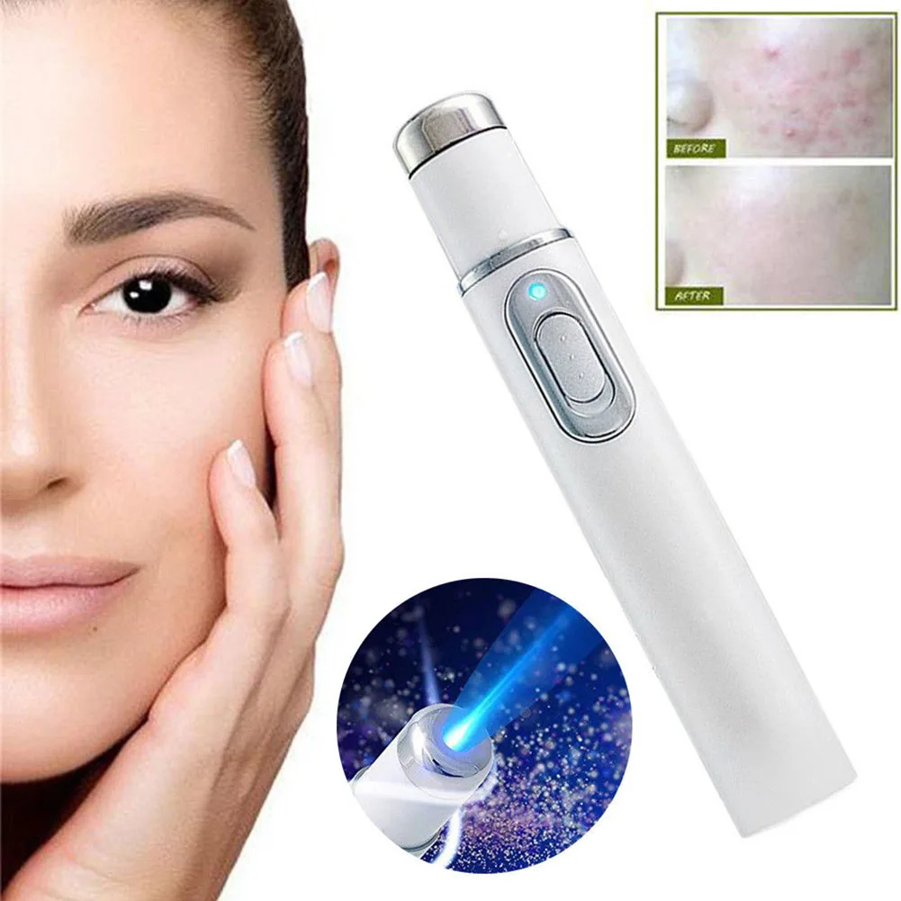 Soft Therapy Acne Laser Pen Blue Light Durable Face Skin Care Tools Massage Portable Scar Remover Machine KD-7910 |