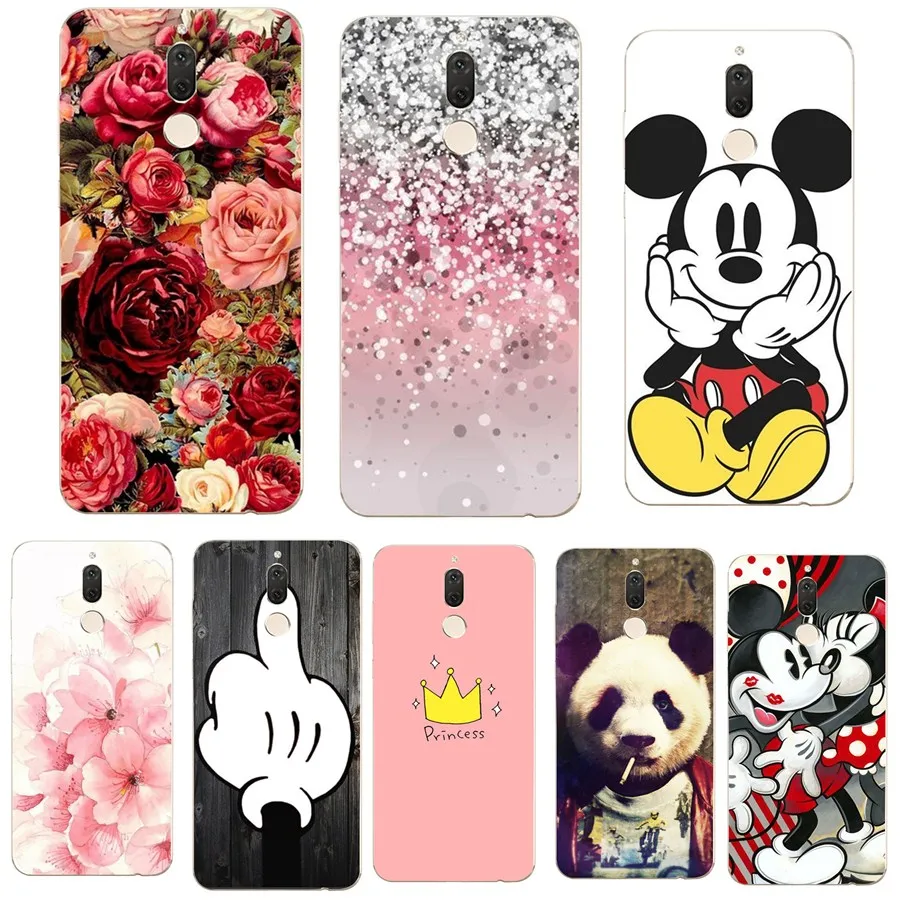 

Soft TPU Silicone For Xiaomi Redmi 4X Case Cover Soft TPU Coque Cover For Xiaomi Mi A1 Redmi 4A Note 4X Note 5A 32G 5 Plus Case