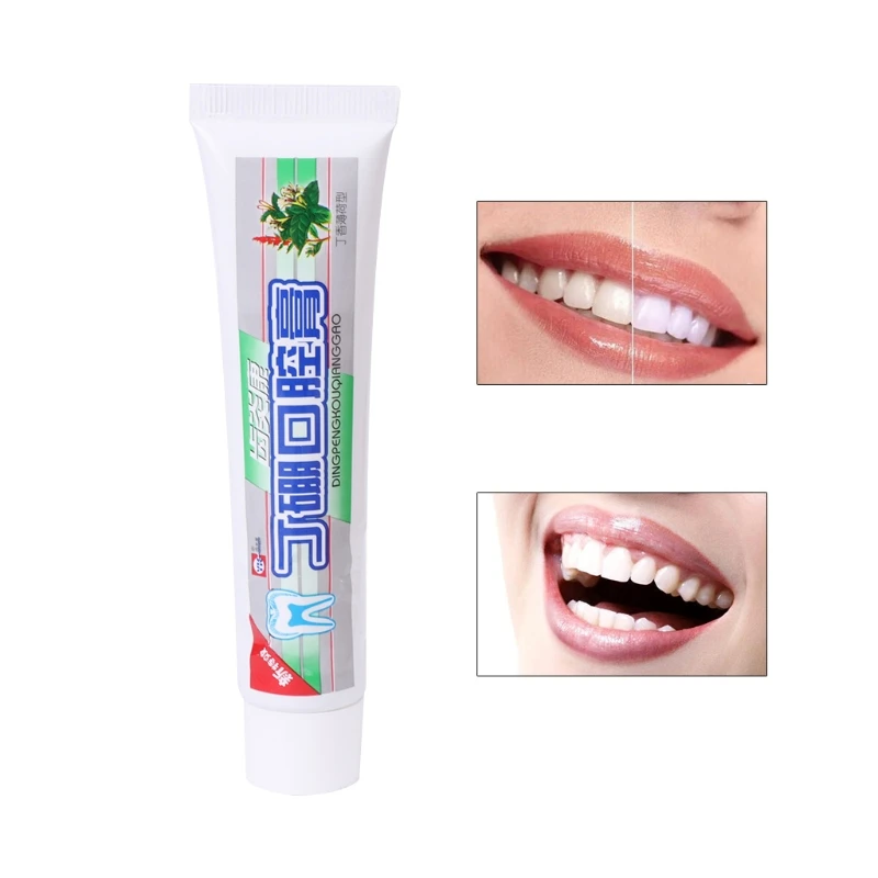 1PC Oral Toothpast Traditional Medicine Eliminate Mouth Odor Oral