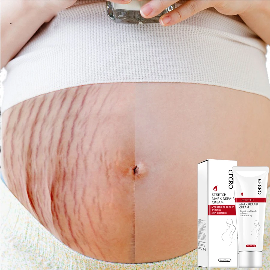EFERO Крем Для Удаления растяжек и шрамов от акне для беременных, антивозрастной крем против морщин, укрепляющий крем для тела
