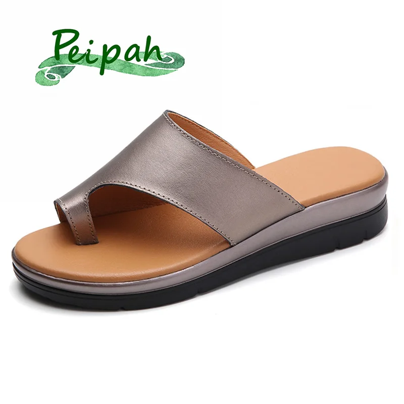 

PEIPAH 2019 Summer Genuine Leather Women Slipper Wedge Correction Sandals Summer Female Shoes Orthopedic Bunion Corrector