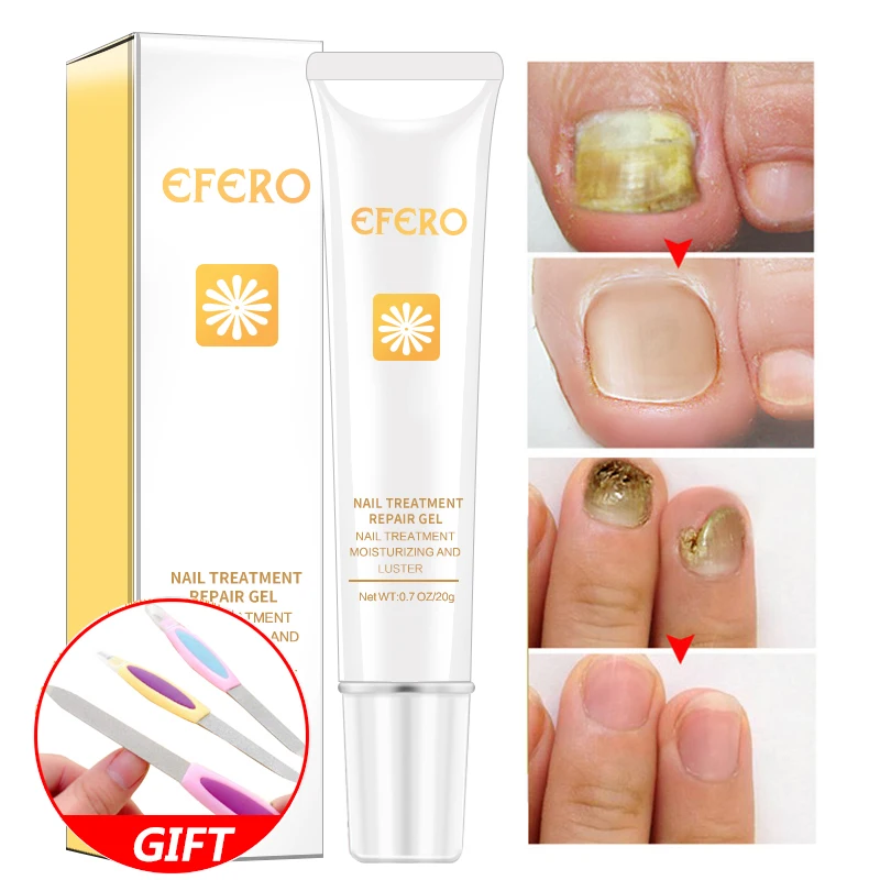 

EFERO Nail Repair Essence Serum Fungal Nail Treatment Remove Onychomycosis Toe Nail Nourishing Brightening Whitening Foot Care