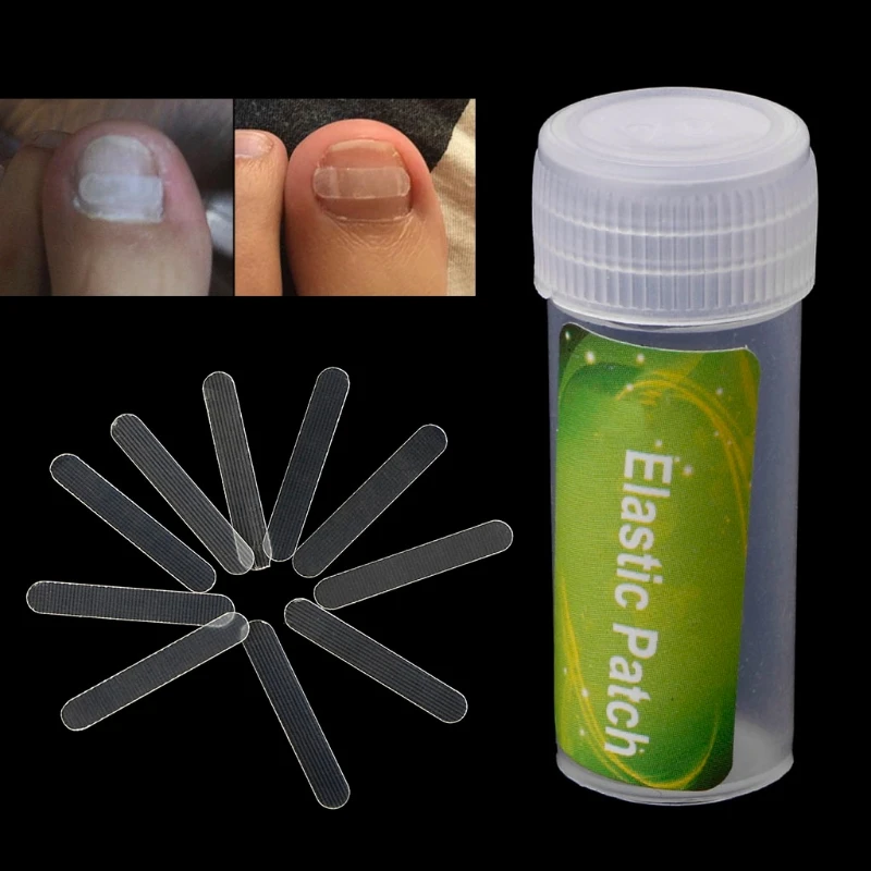 

10Pcs 4MM/3MM Ingrown Toenail Straightening Thickness Clip Correction Paronychia Curved Toenail Straightening Clip