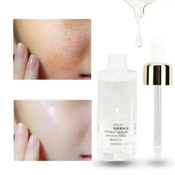 

30ml Freckle Spots skin moist Fading Diluting Serum Face Skin Whitening Liquid