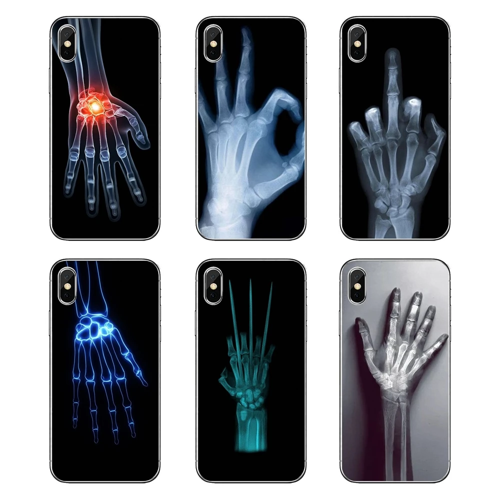 

Transparent Soft Cases Covers For Xiaomi Mi A1 A2 5X 6X 8 lite SE Pro Max Mix 2 2S 3 Mi5 Mi5S Wolverine X-ray Hand Bones Poster