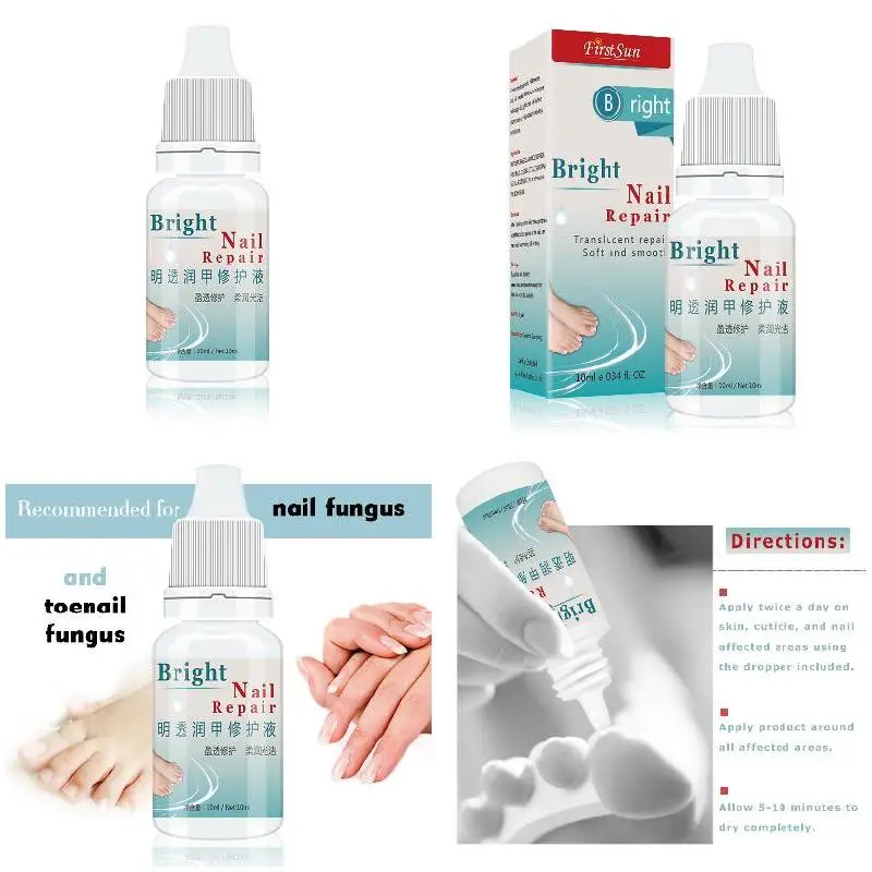 High Quality 10ml Nail Fungal Treatment Anti Fungus Onychomycosis Removal Toenail Care Nails Repair Liquid