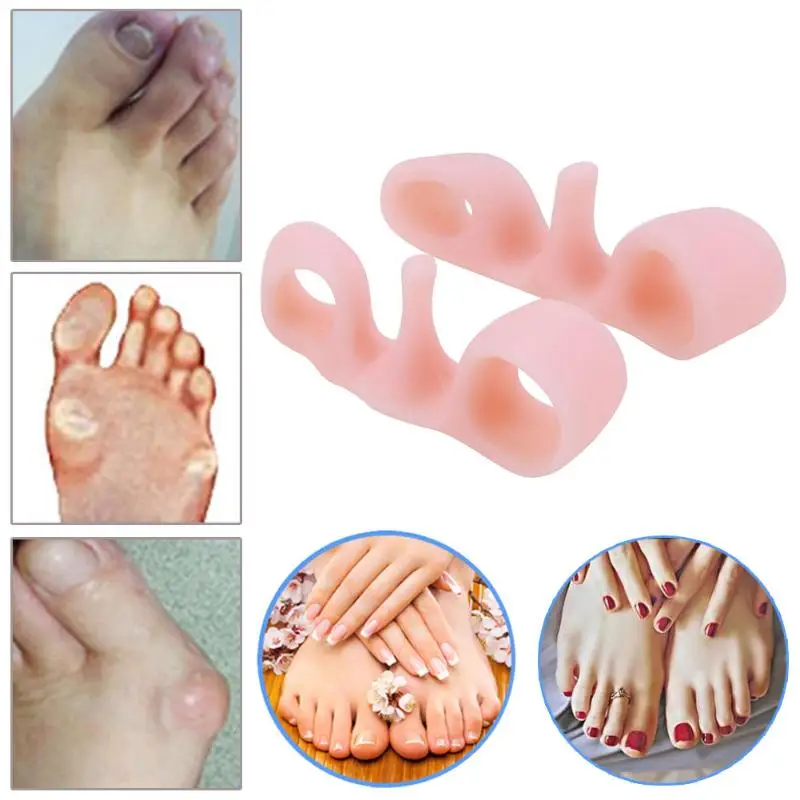 

1pair Toe Separator Finger Hallux Valgus-toed Foot Bones Authentic Overlapping Toe Correction Orthoses Corrective Insoles