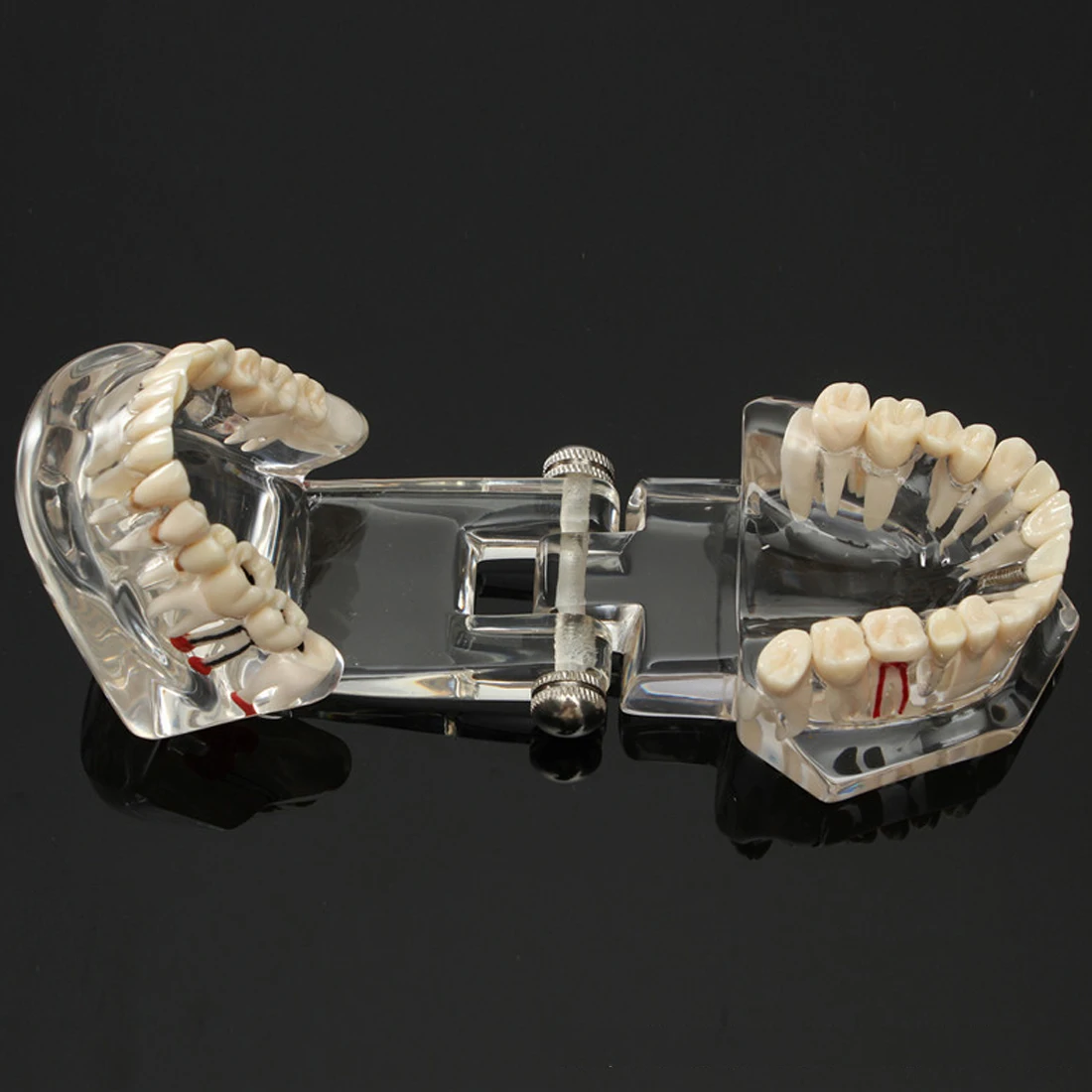 

Top Dental Implant Disease Teeth Model With Restoration Bridge Malocclusion Orthodontic Model For Medical Science Dental