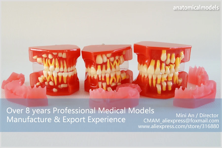 DH/13097, грагически развивающие, От 3 до 6 лет, детская стоматологическая модель, Обучающие анатомические модели