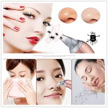 ZD Новая мода 1 шт. портативный инструмент для красоты черная головка для удаления угрей 4 сменные головки многофункциональный инструмент для ухода за лицом XN138M