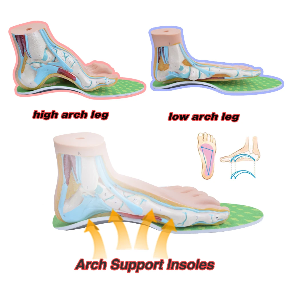 EXPfoot عالية الجودة تقويم العظام هلام عالية قوس دعم النعال هلام وسادة كعب 3D العظام التهاب اللفافة الأخمصية يدعم 35-48 حجم