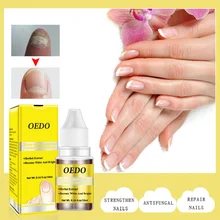 Травяные Антибактериальные Средства для ухода за ногтями эфирное масло растительный экстракт для ногтей грибок Инструменты для ремонта ногтей экстракт женьшеня