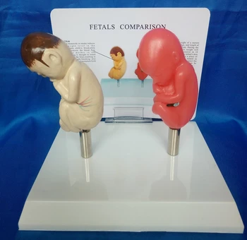 

fetals Comparison set smoking Fetal and Normal Fetals Model Human Body educational model
