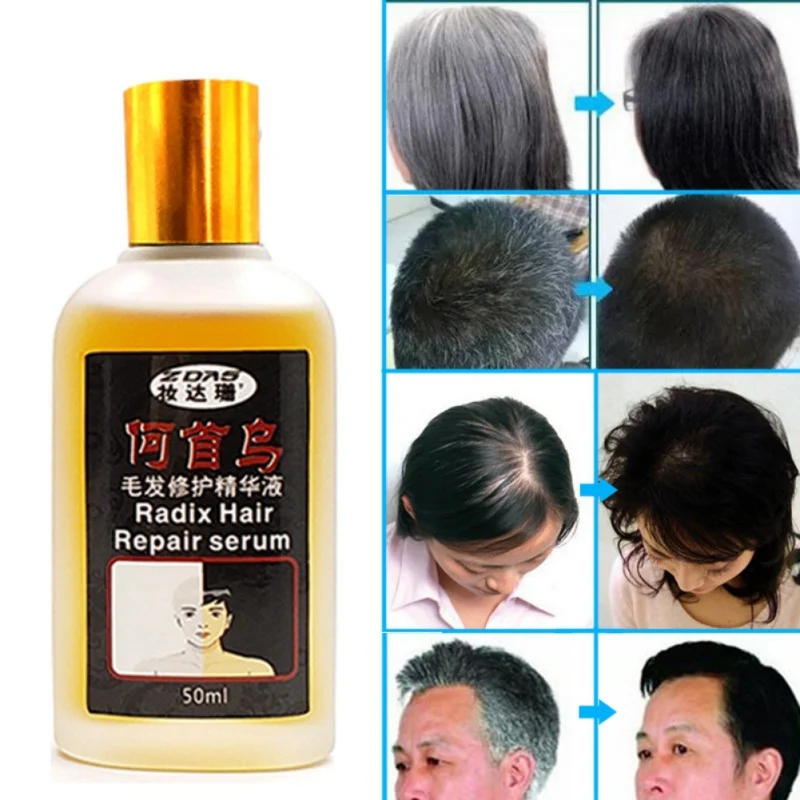 

Polygonum Hair Growth Essence Nourishing Hair Scalp Hair Growth Dense Hair Loss Products Long Lasting